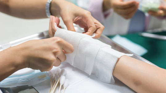 Medical team wrapping a patient’s arm after a burn injury
